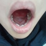 [이게맞냐] 이정도면 무조건 치과 <b>가야</b>겠지..?