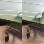 <b>쌍수</b> 잘될거같음?