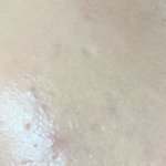 [드루와] 여드름쟁이들아 너네 화<b>장어</b>케함