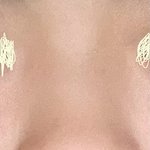 (사진첨부) 이거 콧대빼고 코끝만 코수술 할수있는 <b>코야</b>?