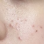 이거 <b>좁쌀</b>임?