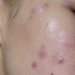 [추반] 약혐)나 피부 이런데 쿠션 뭐 살까