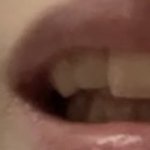 나 고2인데 교정할까(<b>이빨사진</b>있음