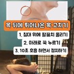 거북목이나 어깨가 굽은 사람에게 있는 <b>버섯</b>증후군 완화 스트레칭
