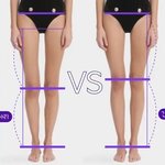 허벅지는 긴데 종아리 짧은 거 스트레스임