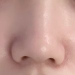 코성형<b>견적</b>좀