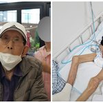 [댓글부탁해] 11일동안 대장내시경을 5차례 받고 결국 사망했습니다