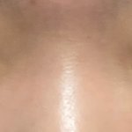 코수술은 내가 ㄹㅈㄷ인듯