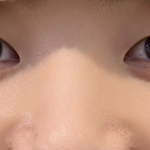 이거 설마 콧속은 코털과.. <b>코옆</b>은 개큰모공인가