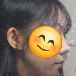 나 <b>무턱</b>+돌출입 개심한데 교정하면 ㄱㅊ을 거 같냐