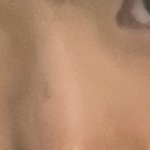 코<b>보정</b> 너무 심함?