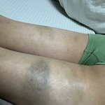 공론화시켜서.교사자질이없는. 폭력행사한교사는.교사직권을 해지하고. <b>처벌</b>받길