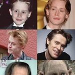 <b>BEFORE</b> &amp; AFTER