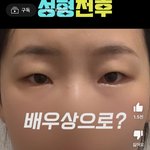 <b>무쌍</b> 트임만으로 이렇게 되는 거 가능함?