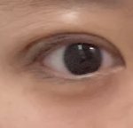 쌍수 <b>당일</b>인데