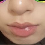 나 교정하면 <b>하관</b>이뻐지기 가능하니?
