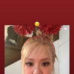 <b>로제</b> 얼굴 무슨일