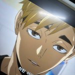 <b>매몰</b>하면 2주 안에 붓기 빠져..?