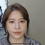 이 사람은 앞트임 <b>복원</b> 엄청 잘된거였네