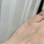 받다가 이렇게 상처내놓고 <b>발뺌</b>하는데 제발 도와주세요ㅠ(사진첨부)