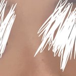 나 콧볼 <b>보정</b>차이 심하지 않냐