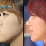 와 <b>성형</b> 전 후 개쩐다