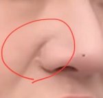 이거 성형 <b>흉터</b>임?