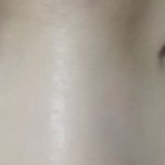 쌍수한지 2주 좀 넘었는데 <b>이럼</b>;