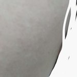 [댓글부탁해] 혐주의) 이거 <b>좁쌀</b> 여드름이야??