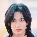 라이즈 원빈 최근 얼굴 상태