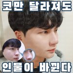 [댓글부탁해] 이런눈은 어떻게 성형해야함...?