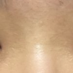 나 쌍수 <b>짝짝이</b>로된건가?ㅠ