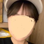 [드루와] 얼굴형 <b>시술</b> 효과 있는거같냐
