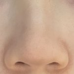 내 코 였으면 성형/<b>시술</b>