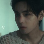 <b>뷔</b> 눈 한 쪽이 이상함