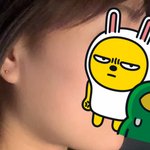 [사진첨부]<b>침샘</b>보톡스 맞을까요?