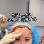 이수술 대박이다
