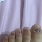 나만 <b>발톱</b>뽑는거 좋아하냐 (+사진첨부/혐짤주의)