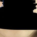 [댓글부탁해] 피부에 이거 어떻게없애 ,,?