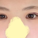 [19] 쌍수했는데 친구한테 <b>의버지</b> 소리들었다