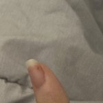 [댓글부탁해] <b>손톱</b> 밑 찔려본 사람..ㅜㅜㅜ