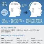 최근 강남에서 유행한다는 뒷통수 시멘트성형