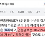 이거 진짜여요? 여자들 <b>에이즈</b> 이렇게 많이 걸렸어요?