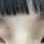 [댓글부탁해] 니네 <b>눈썹</b>밑에 여드름 나봤니..?