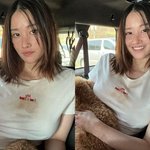 <b>자연</b> a vs 수술c 남자만투표
