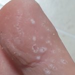 혐주의) 이거 왜 그런 거임? ㅈㅂㅜ