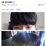 [댓글부탁해] 앞트임하면 진짜 <b>이케</b>됨??
