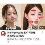 일본 유튜버의 장원영 <b>성형설</b>