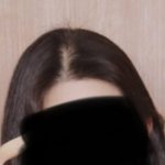 정수리 왜<b>저럼</b> 탈모임?