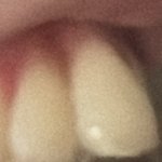 나보다 <b>앞니</b> 못생긴사람 있으려나